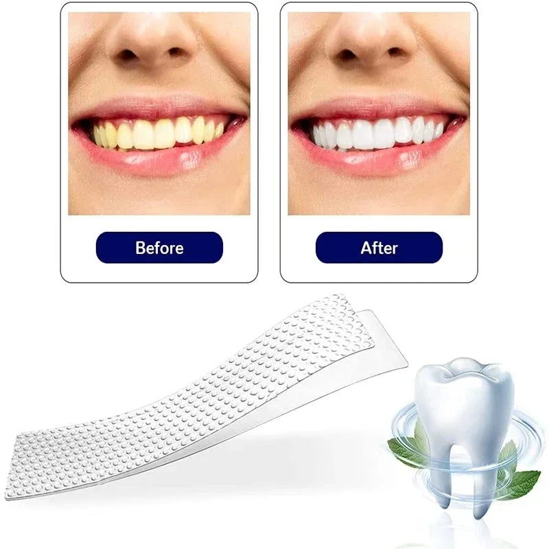 Bright Smile Whitening Kit